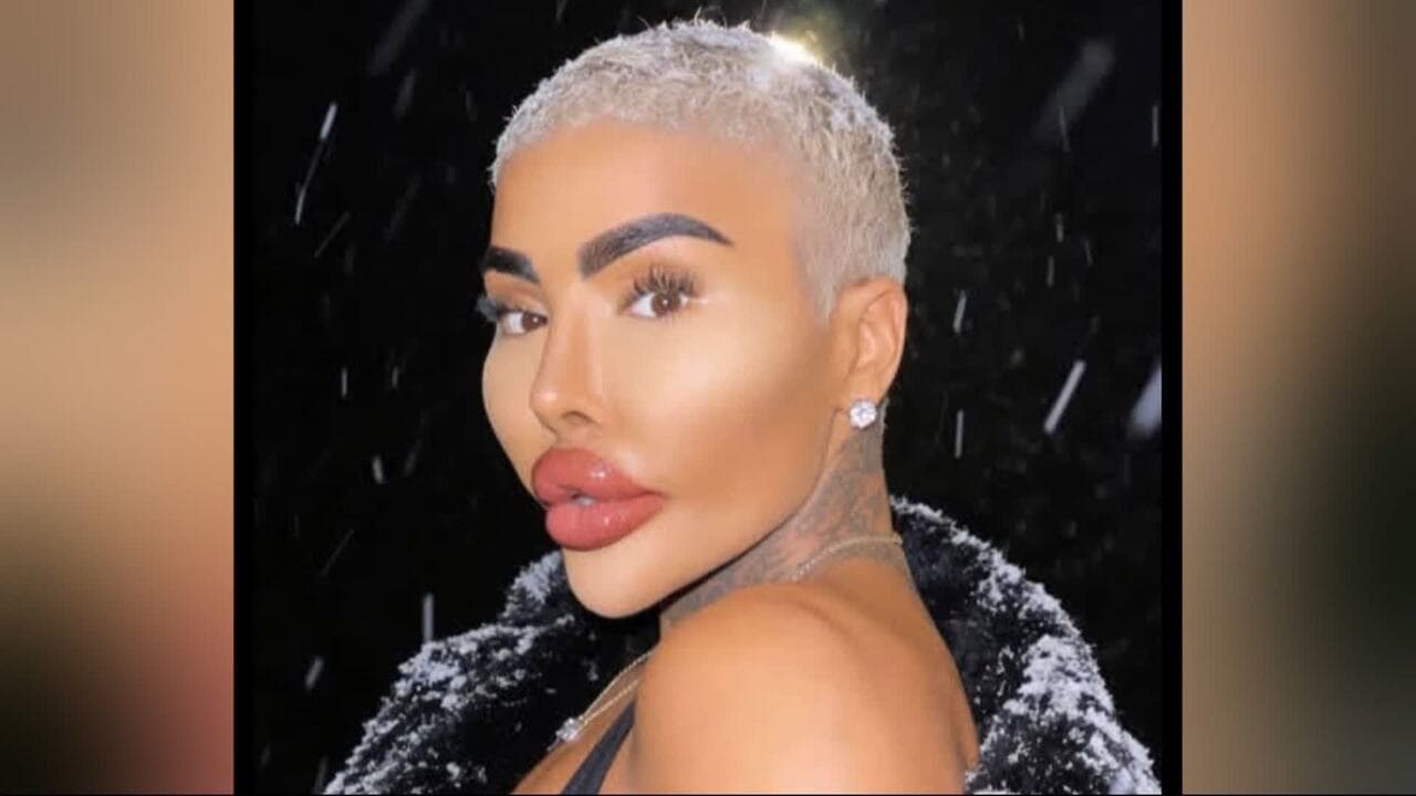 Botched Star and Lip King Jordan James Tragic Passing