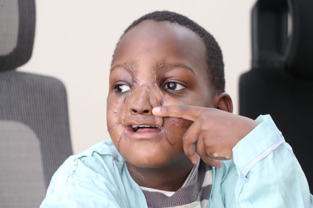 KNH Surgeons Restore Hope to Boy in World-First Surgery