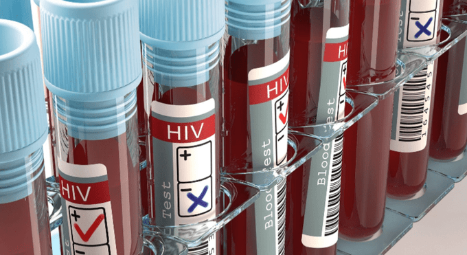HIV Infections Spike 19% as Nairobi Becomes Epicentre